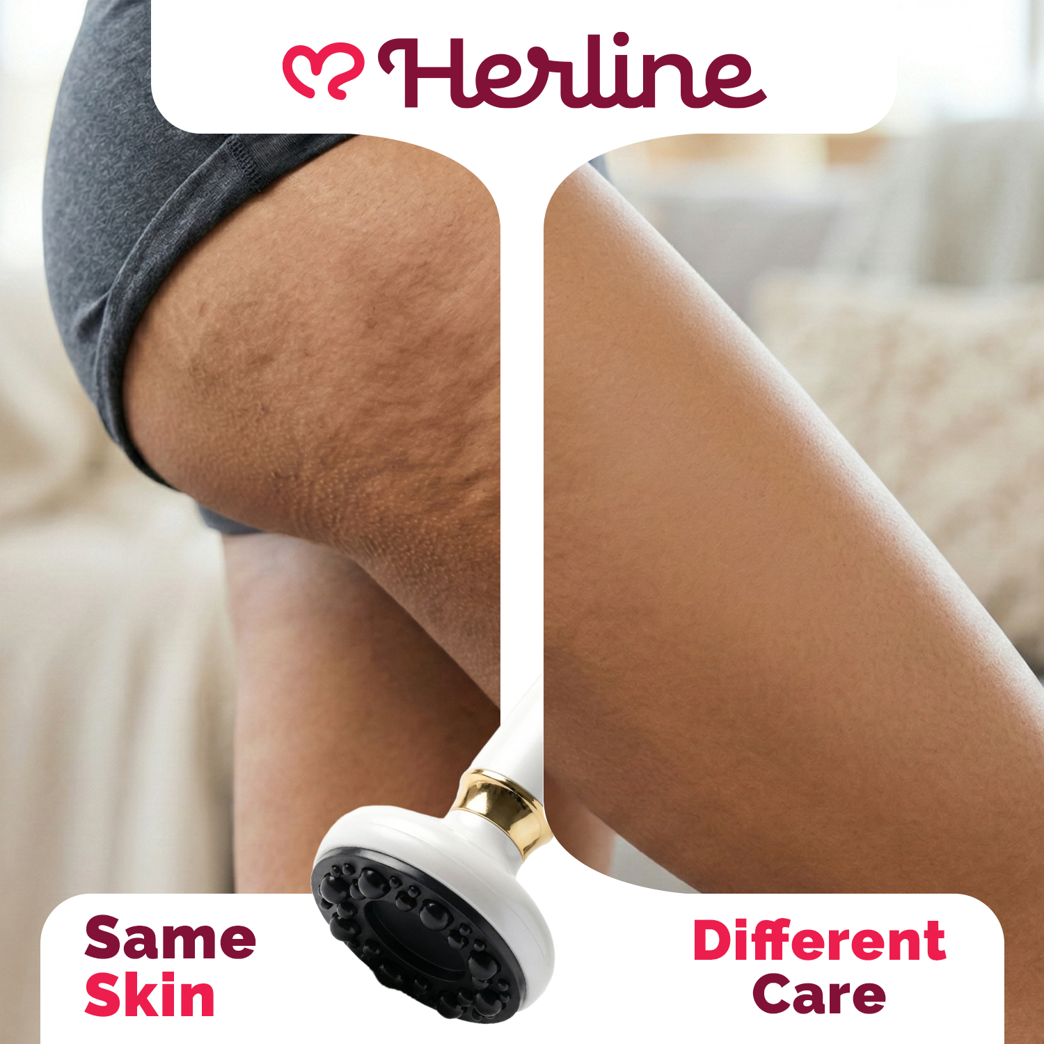 Herline Anti Cellulite Massager