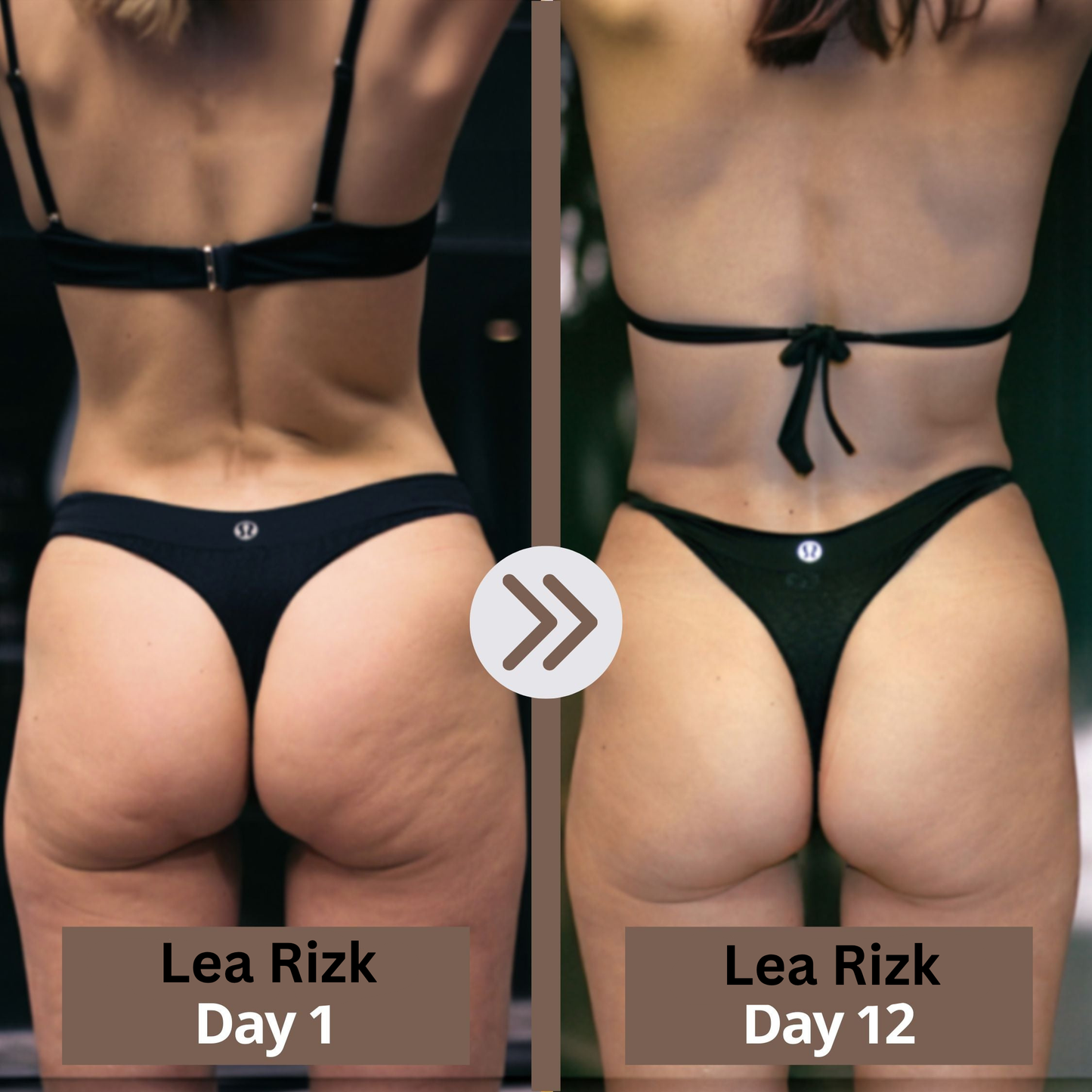 GLOWBEE™ Anti-Cellulite Massager