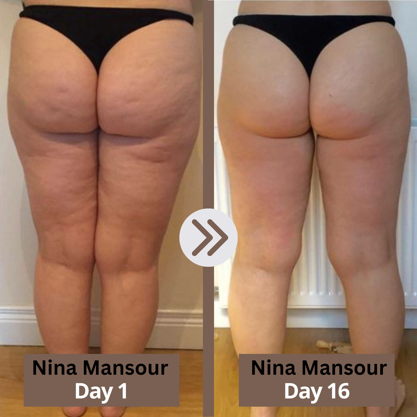 GLOWBEE™ Anti-Cellulite Massager