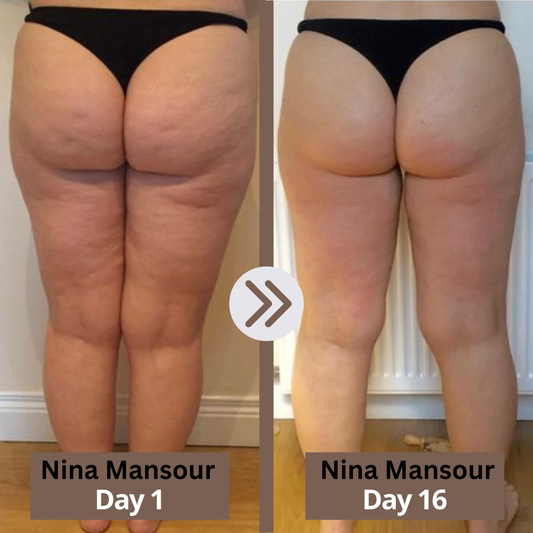 GLOWBEE™ Anti-Cellulite Massager