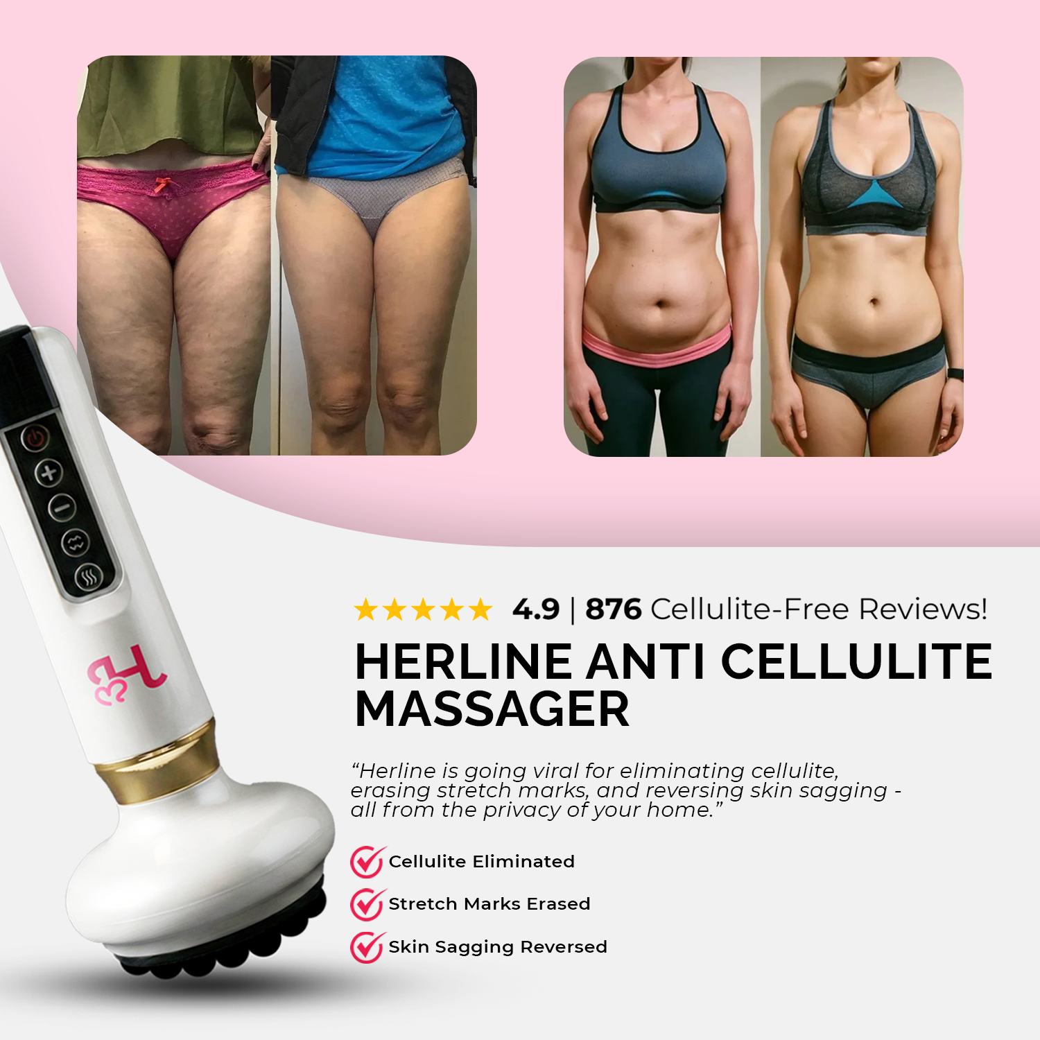 Herline Anti Cellulite Massager